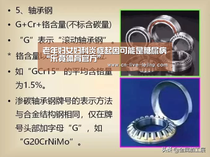 老年妇女妇科炎症起因可能是糖尿病“乐竟体育官方”(图2) 乐竟体育官方