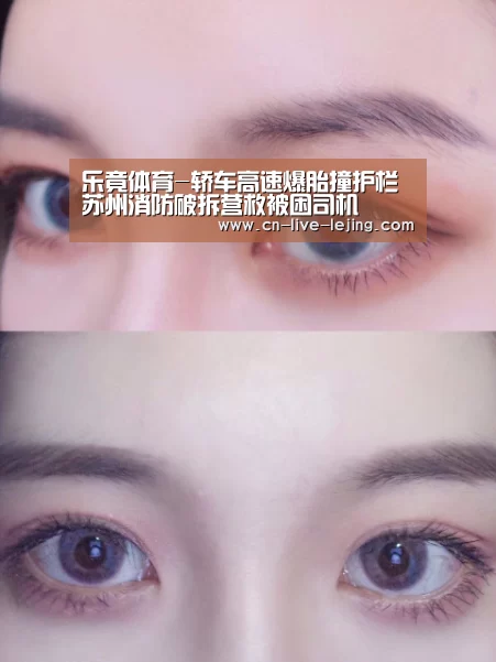乐竟体育-轿车高速爆胎撞护栏 苏州消防破拆营救被困司机(图1) 乐竟官方